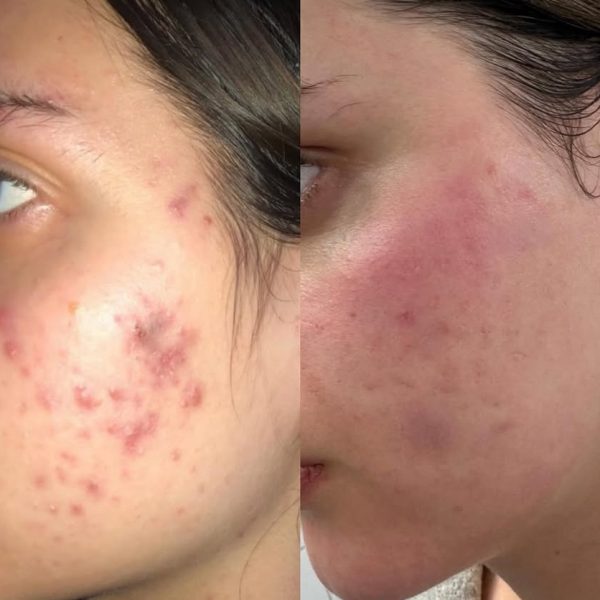 Beauty by Mel / Melissa Krebs